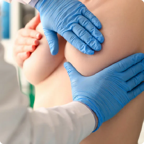 Médico especialista realizando consulta sobre cirugía oncoplástica de mama con una paciente