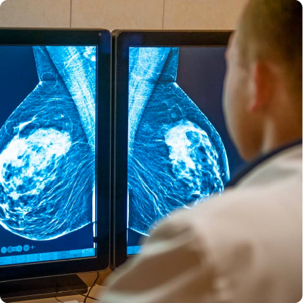 Prevención y tratamiento de cáncer de mama por cirujano